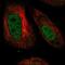 SWI/SNF Related, Matrix Associated, Actin Dependent Regulator Of Chromatin, Subfamily D, Member 3 antibody, NBP2-57036, Novus Biologicals, Immunocytochemistry image 