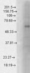 Gamma-Aminobutyric Acid Type A Receptor Beta1 Subunit antibody, NBP1-48319, Novus Biologicals, Western Blot image 