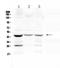 Pulmonary surfactant-associated protein B antibody, A03441-1, Boster Biological Technology, Western Blot image 