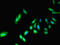 Protein Phosphatase 2 Catalytic Subunit Beta antibody, CSB-PA00985A0Rb, Cusabio, Immunofluorescence image 