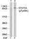 STAT5A antibody, TA309958, Origene, Western Blot image 