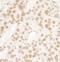FUS RNA Binding Protein antibody, NB100-2599, Novus Biologicals, Immunohistochemistry paraffin image 