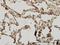Interleukin 1 Receptor Associated Kinase 1 antibody, H00003654-M02, Novus Biologicals, Immunohistochemistry paraffin image 