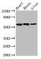 Aldehyde Dehydrogenase 5 Family Member A1 antibody, LS-C369223, Lifespan Biosciences, Western Blot image 