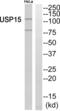 Ubiquitin Specific Peptidase 15 antibody, abx014973, Abbexa, Western Blot image 