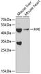 Hereditary hemochromatosis protein antibody, GTX54085, GeneTex, Western Blot image 
