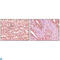 EPH Receptor A2 antibody, LS-C812451, Lifespan Biosciences, Immunohistochemistry paraffin image 