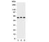 Pyruvate Kinase M1/2 antibody, R31156, NSJ Bioreagents, Western Blot image 