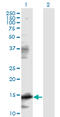 Eukaryotic Translation Initiation Factor 5A antibody, LS-C197122, Lifespan Biosciences, Western Blot image 