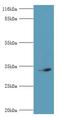 Cyclin Dependent Kinase 5 antibody, MBS7001440, MyBioSource, Western Blot image 