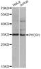 Pyrroline-5-Carboxylate Reductase 1 antibody, LS-C748400, Lifespan Biosciences, Western Blot image 