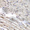 Heterogeneous Nuclear Ribonucleoprotein M antibody, A6937, ABclonal Technology, Immunohistochemistry paraffin image 