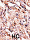 Branched Chain Keto Acid Dehydrogenase Kinase antibody, 62-669, ProSci, Immunohistochemistry paraffin image 