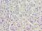 Acid Phosphatase 1 antibody, LS-C375130, Lifespan Biosciences, Immunohistochemistry paraffin image 