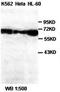 Matrix Metallopeptidase 24 antibody, orb77329, Biorbyt, Western Blot image 