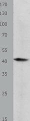 Bone Morphogenetic Protein 4 antibody, TA323208, Origene, Western Blot image 