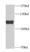 Glucosamine (UDP-N-Acetyl)-2-Epimerase/N-Acetylmannosamine Kinase antibody, FNab03544, FineTest, Western Blot image 