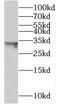 Transmembrane Protein 106B antibody, FNab08744, FineTest, Western Blot image 