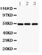 Solute Carrier Family 2 Member 1 antibody, PA1120-1, Boster Biological Technology, Western Blot image 