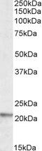 AP2 Associated Kinase 1 antibody, orb20340, Biorbyt, Western Blot image 