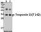 Troponin I3, Cardiac Type antibody, A01720T142, Boster Biological Technology, Western Blot image 