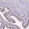 Zinc Finger CCCH-Type Containing 4 antibody, HPA040934, Atlas Antibodies, Immunohistochemistry paraffin image 
