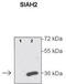 Siah E3 Ubiquitin Protein Ligase 2 antibody, TA344469, Origene, Western Blot image 