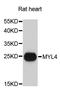 Myosin Light Chain 4 antibody, A13031, ABclonal Technology, Western Blot image 