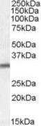 Proteasome Assembly Chaperone 1 antibody, PA5-19076, Invitrogen Antibodies, Western Blot image 