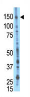 BMP2 Inducible Kinase antibody, AP11673PU-N, Origene, Western Blot image 