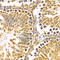 Progesterone Immunomodulatory Binding Factor 1 antibody, A3072, ABclonal Technology, Immunohistochemistry paraffin image 