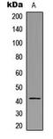 Putative HLA class I histocompatibility antigen, alpha chain H antibody, MBS8226170, MyBioSource, Western Blot image 