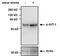 GIT ArfGAP 1 antibody, PA5-12982, Invitrogen Antibodies, Western Blot image 