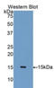 Interleukin 15 antibody, LS-C299420, Lifespan Biosciences, Western Blot image 