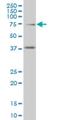 Transcription Factor 4 antibody, H00006925-M04, Novus Biologicals, Western Blot image 