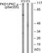 Protein Kinase D1 antibody, PA5-38420, Invitrogen Antibodies, Western Blot image 