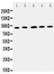 Intercellular Adhesion Molecule 1 antibody, PA5-79430, Invitrogen Antibodies, Western Blot image 