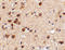 STE20/SPS1-related proline-alanine-rich protein kinase antibody, 4867, ProSci, Immunohistochemistry paraffin image 