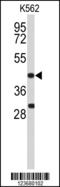 DNA Fragmentation Factor Subunit Alpha antibody, LS-C167373, Lifespan Biosciences, Western Blot image 