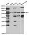 Lymphocyte Specific Protein 1 antibody, abx004294, Abbexa, Western Blot image 