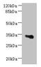 Armadillo Repeat Containing X-Linked 6 antibody, CSB-PA765977LA01HU, Cusabio, Western Blot image 