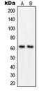 Growth Factor Receptor Bound Protein 14 antibody, LS-C352265, Lifespan Biosciences, Western Blot image 