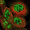 CDC42 Binding Protein Kinase Beta antibody, NBP1-81440, Novus Biologicals, Immunofluorescence image 