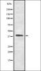 Tachykinin Receptor 2 antibody, orb337296, Biorbyt, Western Blot image 
