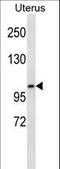Kinase suppressor of Ras 2 antibody, LS-C164437, Lifespan Biosciences, Western Blot image 