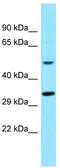 Taste 2 Receptor Member 16 antibody, TA331235, Origene, Western Blot image 