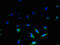 Uncoupling Protein 3 antibody, LS-C394754, Lifespan Biosciences, Immunofluorescence image 