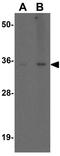 Sex Hormone Binding Globulin antibody, GTX17222, GeneTex, Western Blot image 