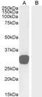 Growth Differentiation Factor 15 antibody, PA5-18415, Invitrogen Antibodies, Western Blot image 