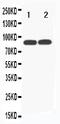 Transferrin Receptor 2 antibody, PA1901, Boster Biological Technology, Western Blot image 